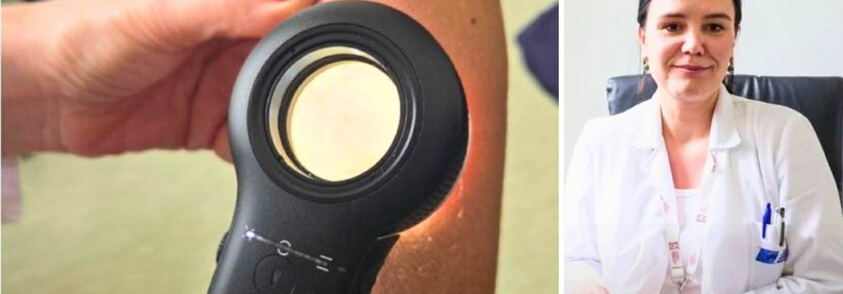 Besplatni pregledi mladeža u Domu zdravlja Travnik u okviru Euromelanoma kampanje