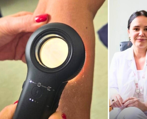 Besplatni pregledi mladeža u Domu zdravlja Travnik u okviru Euromelanoma kampanje